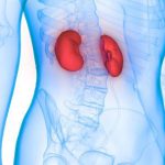 কিডনী ক্যান্সার